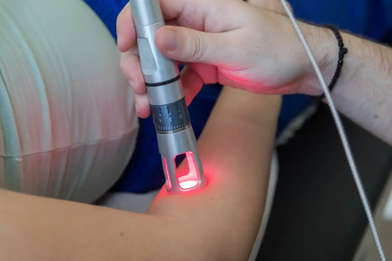 How exactly does laser therapy help, with pilonidal cysts treatment